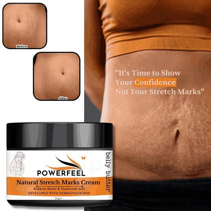 Organic Stretch Mark Cream Oil Mark Removal - Natural Heal Pregnancy Breast, Legs, after pregnancy delivery