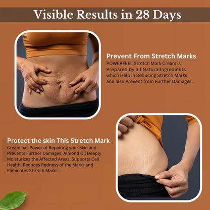 Organic Stretch Mark Cream Oil Mark Removal - Natural Heal Pregnancy Breast, Legs, after pregnancy delivery